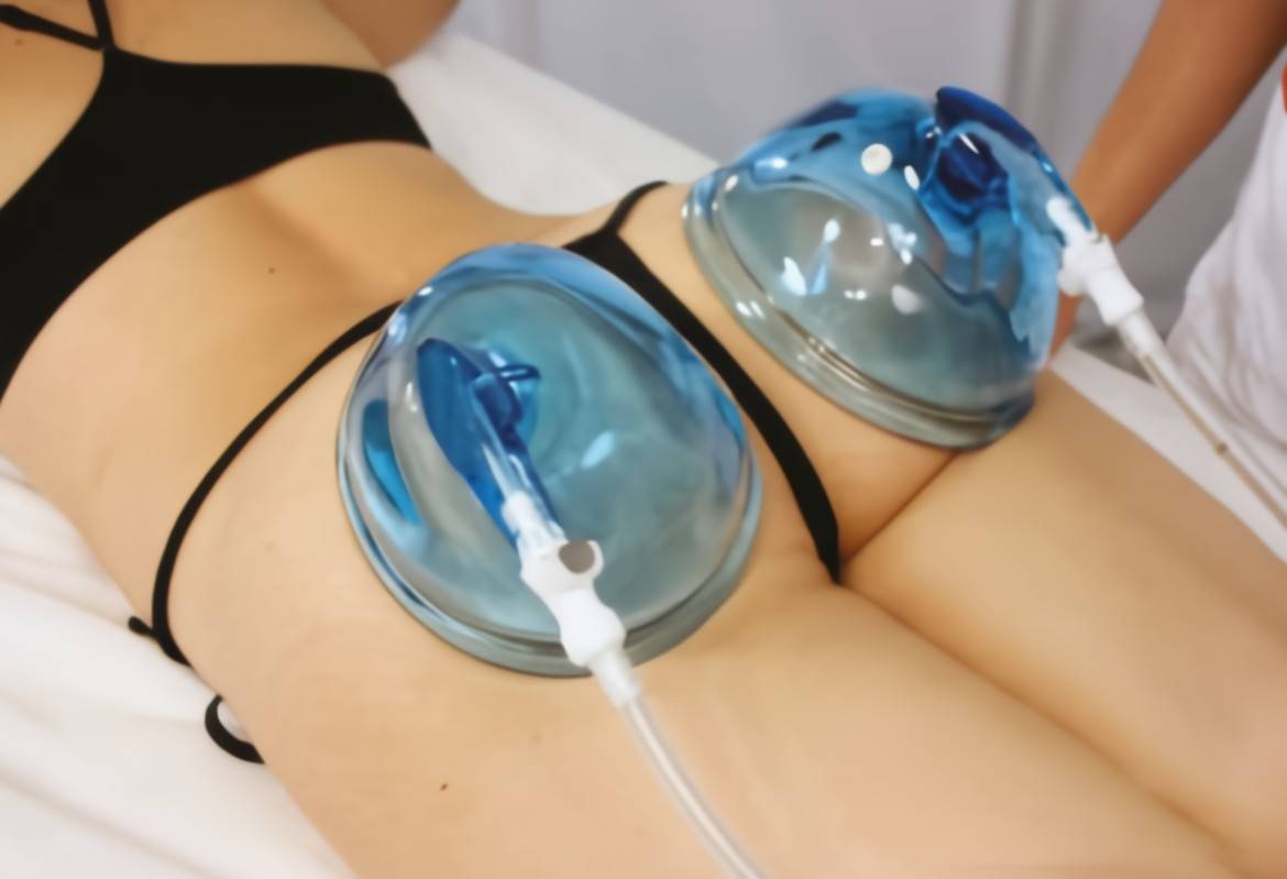 Formation Lifting Colombien