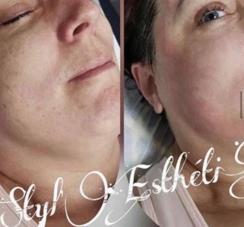 Formation combi skin-care — 2j